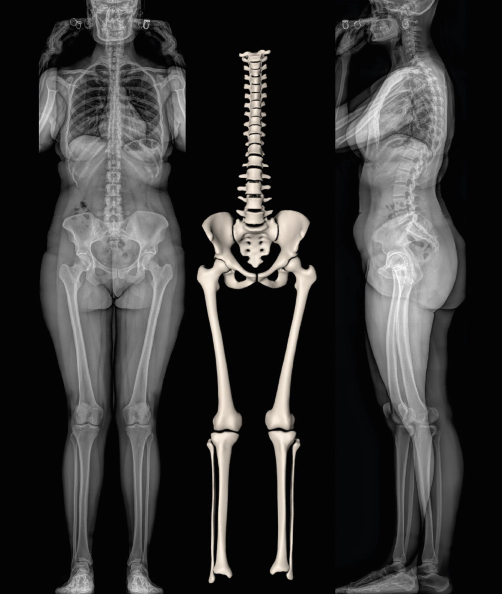 Eosedge full body x ray and 3d